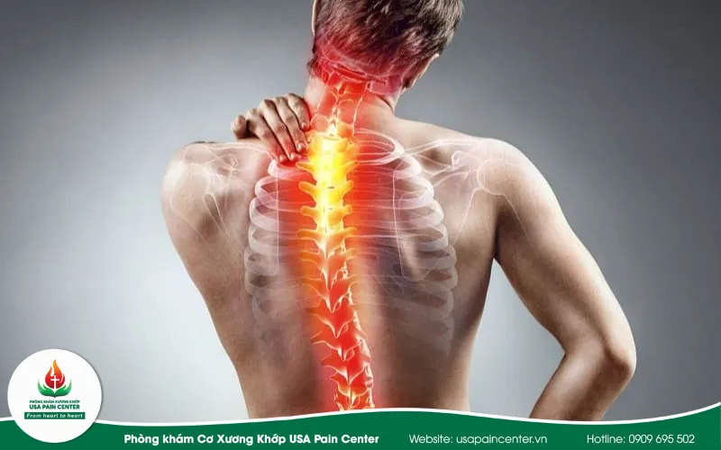đau xương khớp và thần kinh