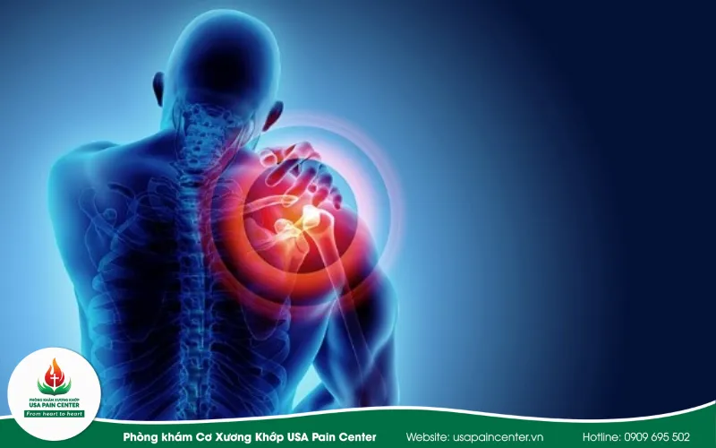 các tình trạng đau khớp
