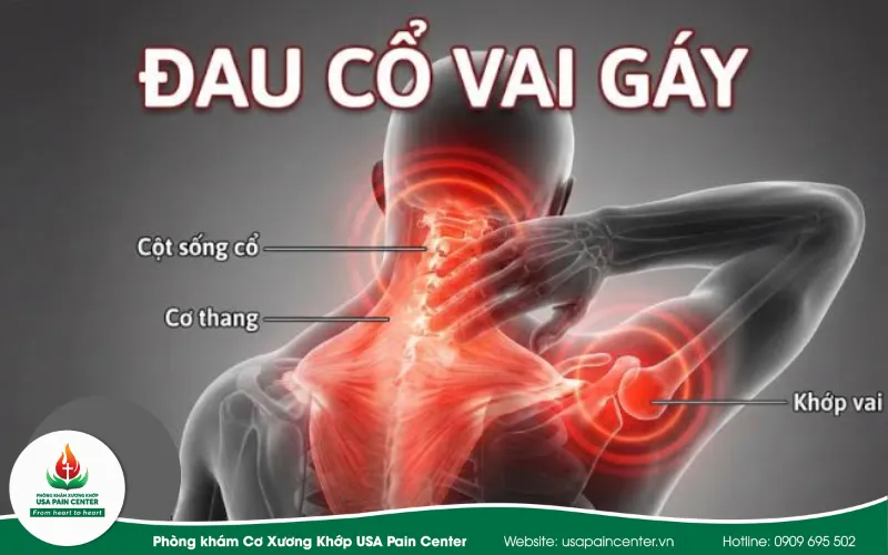 5 Nguyên nhân Đau cổ vai gáy ít ai ngờ tới