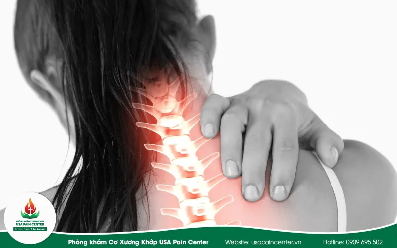 3 bước điều trị hiệu quả đau cổ vai gáy sau nhiễm Covid