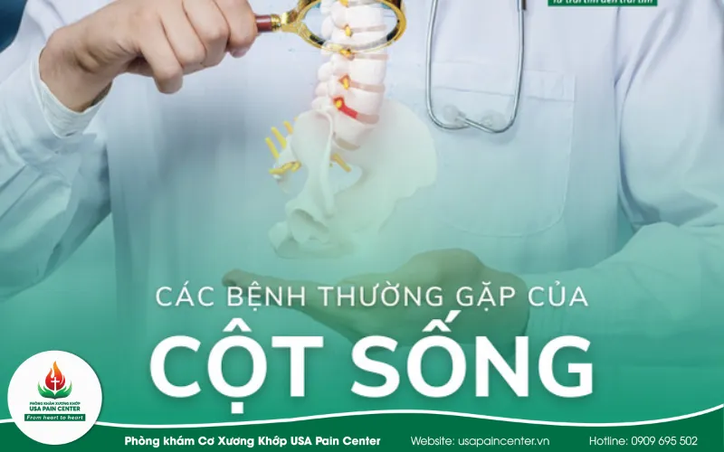 Các bệnh thường gặp của cột sống