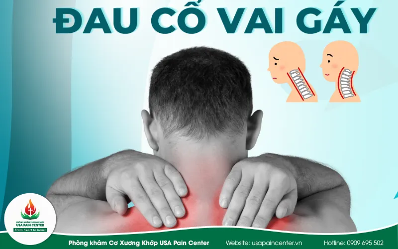 Đau cổ vai gáy: Nguyên nhân, triệu chứng, chẩn đoán và điều trị