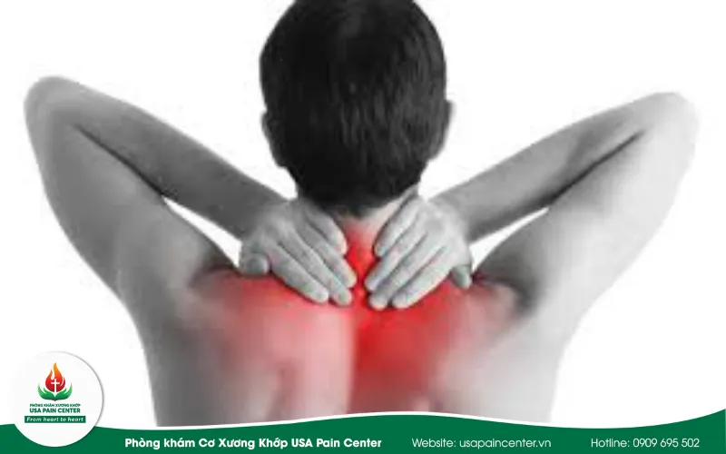 triệu chứng đau cổ vai gáy