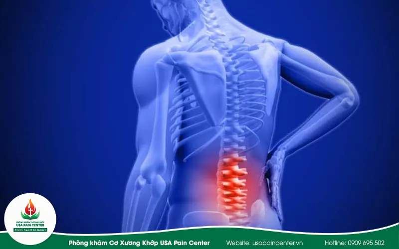 Đau lưng là các cơn đau tê dọc hay gần cột sống