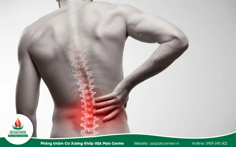 Chấn thương lưng dưới