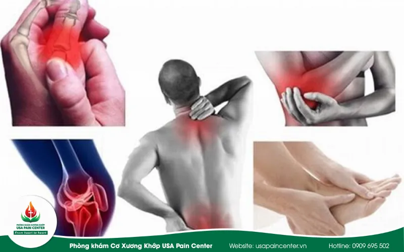 Có tất cả bao nhiêu bệnh liên quan cơ xương khớp?