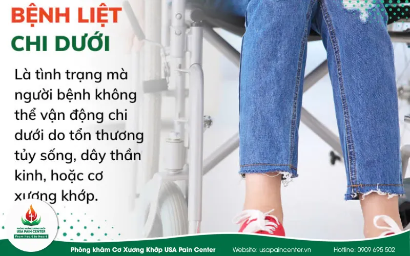 Bệnh liệt chi dưới là gì? Phương pháp điều trị an toàn