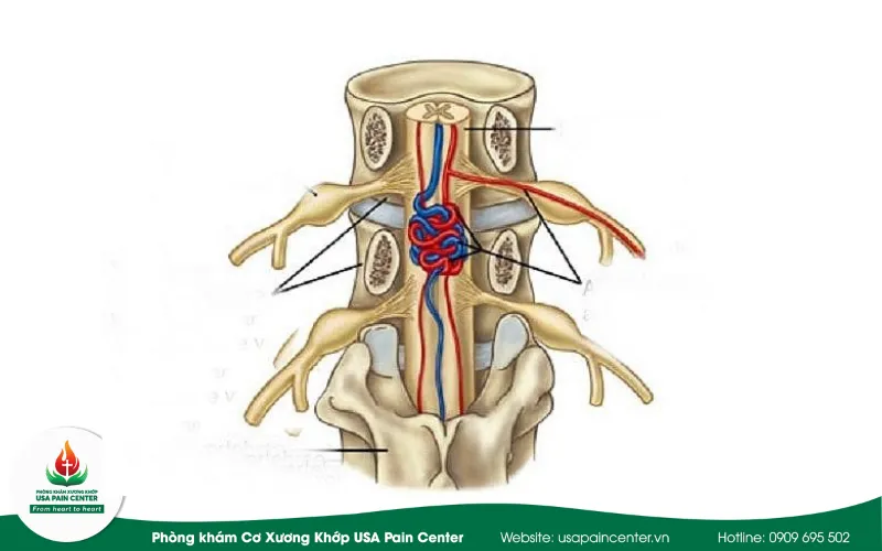 tổn thương tủy sống gây liệt chi dưới