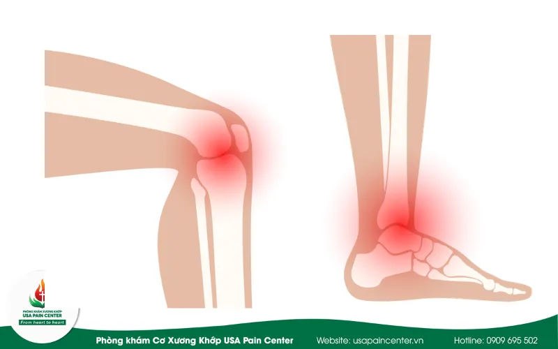 chấn lương chi dưới