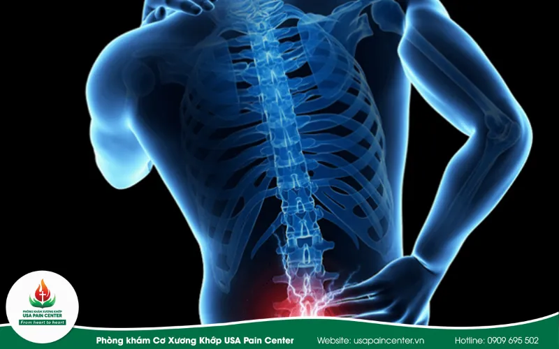 dấu hiệu bệnh liệt