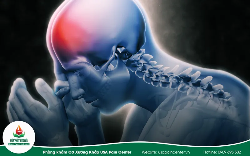 bệnh liên quan đến thần kinh do xương khớp