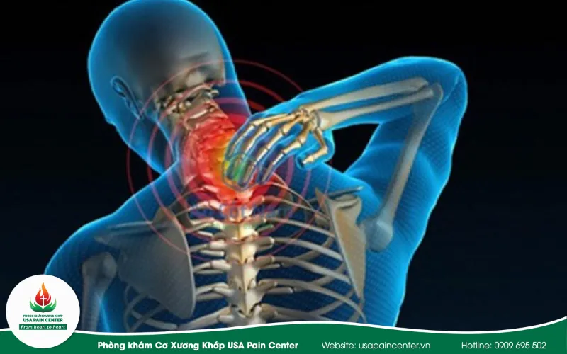 lạm dụng thuốc giảm đau để tránh các cơn đau âm thầm