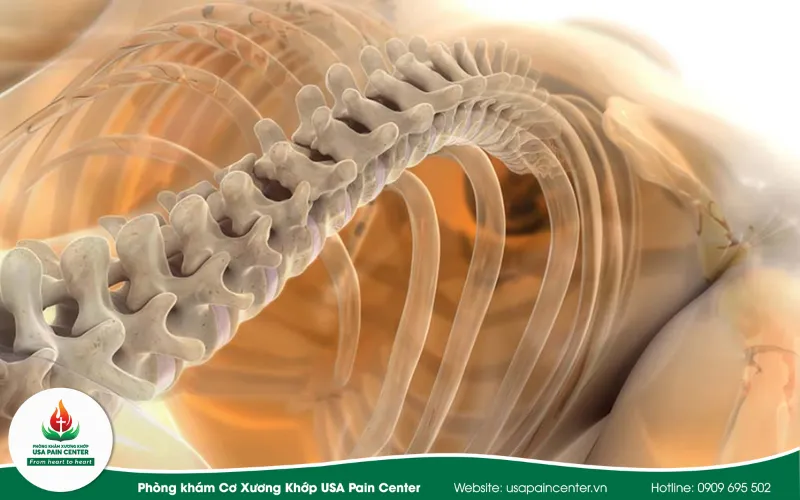 Phương pháp trị liệu thần kinh cột sống
