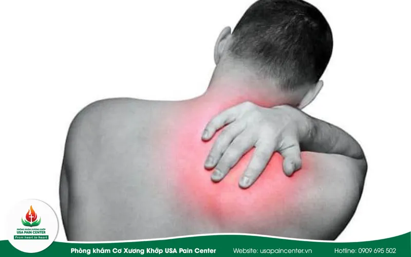 nhói và tê ở vùng cổ sau khi trị liệu cột sống