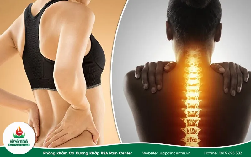 Đau lưng và hiểm họa khi bước nhầm phòng tập yoga