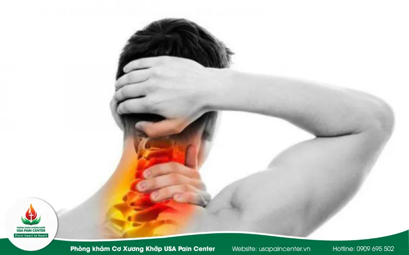 Nguyên nhân và giải pháp điều trị toàn diện cho chứng đau cổ vai gáy