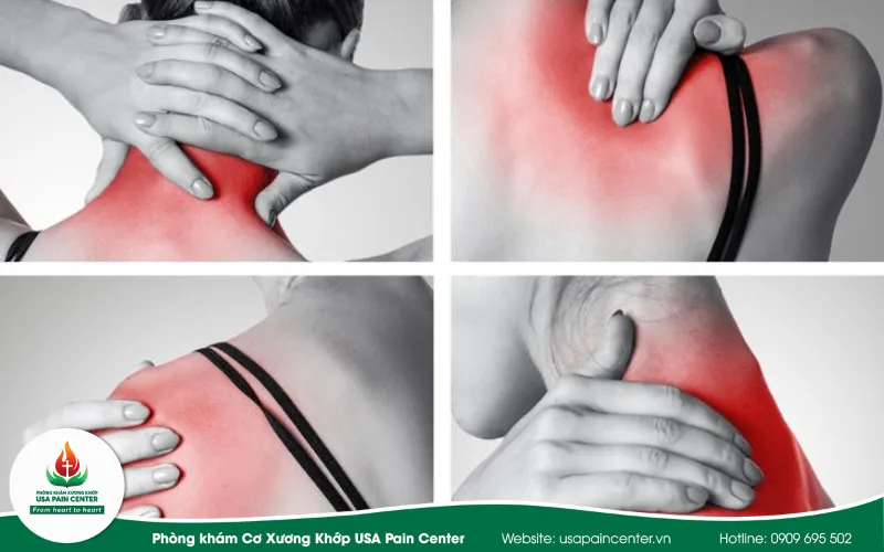 tiệu chứng đau cổ vai gáy