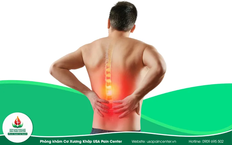 Điều trị mọi cơn đau lưng