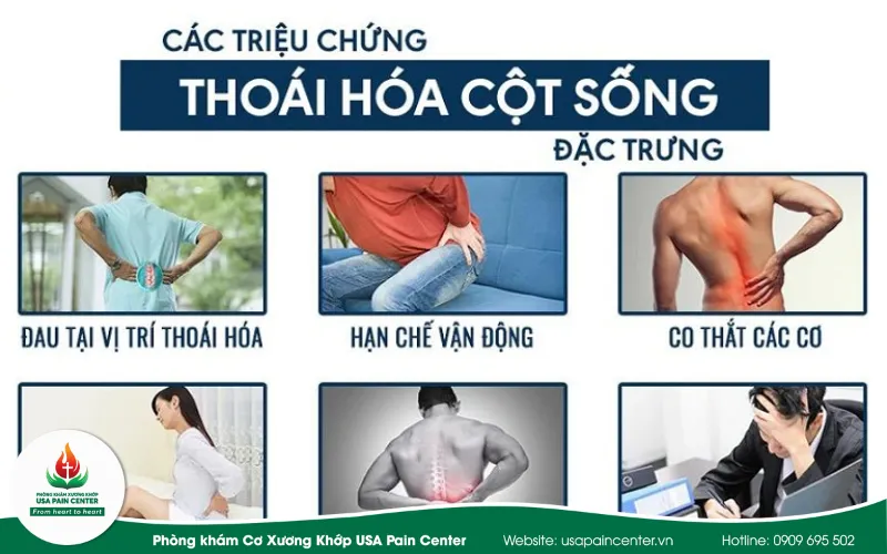 Các dạng bệnh lý thoái hóa cột sống