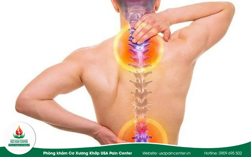 Giải pháp điều trị gai cột sống an toàn giúp phục hồi vận động