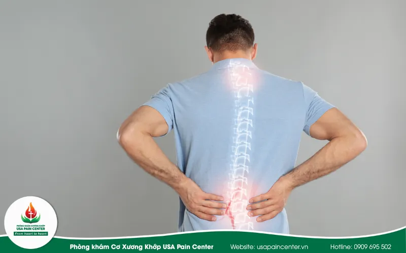 đau nhức cột sống