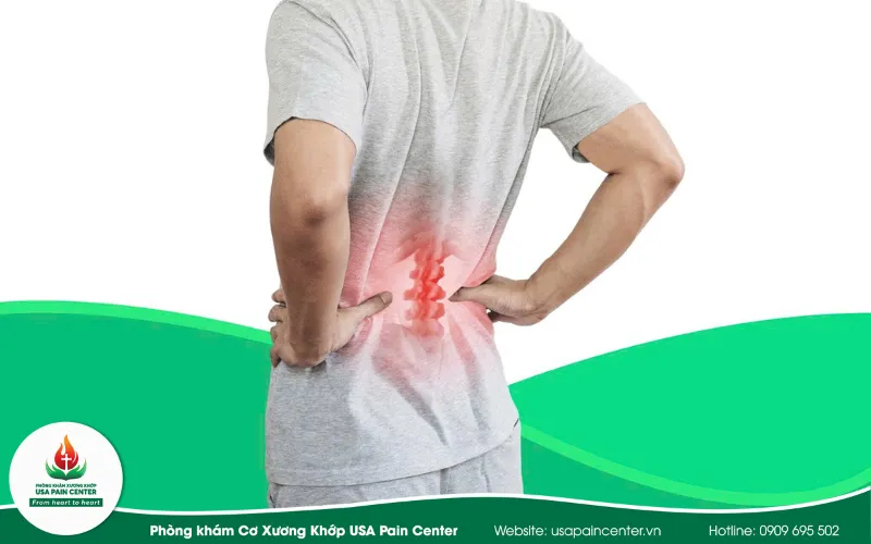Giải pháp hiệu quả cho bệnh thoát vị đĩa đệm