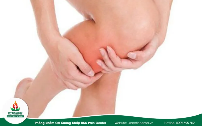 rối loạn cơ mô mềm gây đau lưng