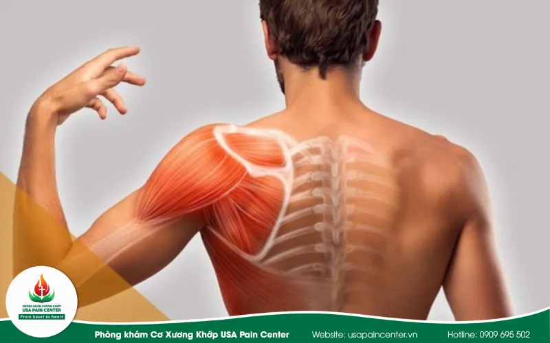 chấn thuogn khớp vai