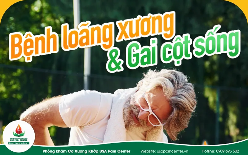 Tại sao loãng xương dễ dẫn đến gai cột sống