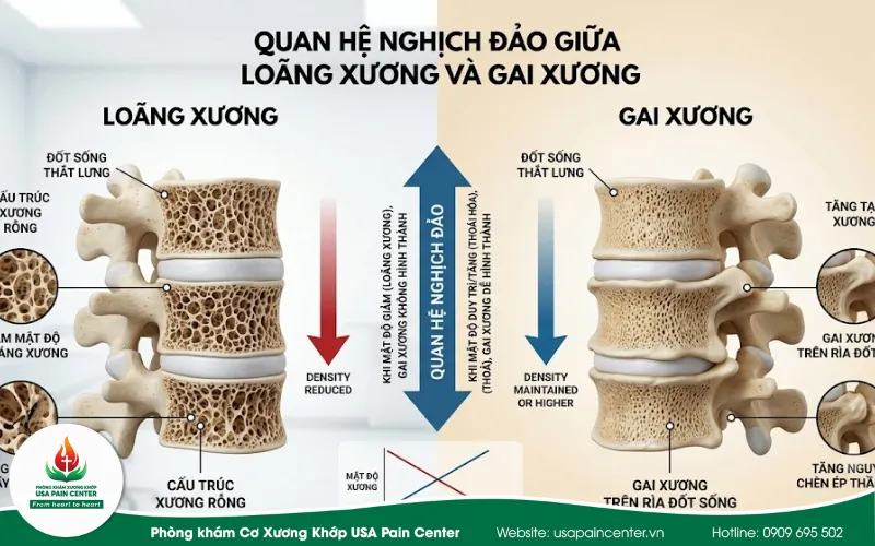 Mối quan hệ nghịch đảo giữa người bị loãng xương và gai cột sống
