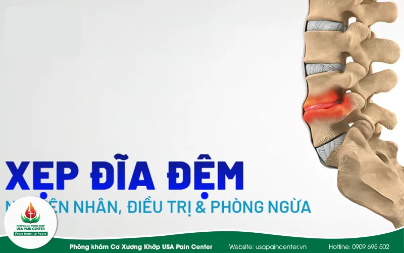 Các đĩa đệm của cột sống có chiều cao giảm - Xẹp đĩa đệm