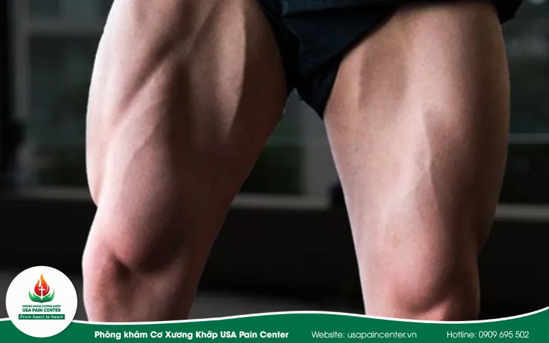 Kỹ thuật phục hồi cơ gân kheo tầng sâu cho người chơi thể thao