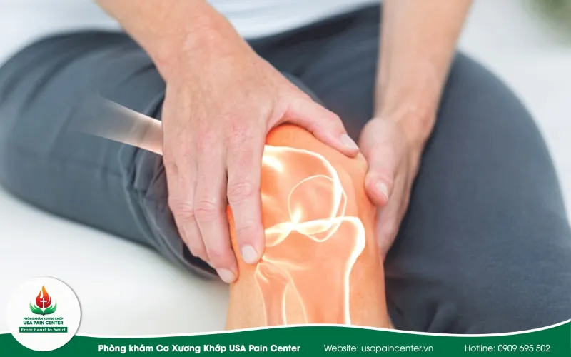 gia cố khớp gối