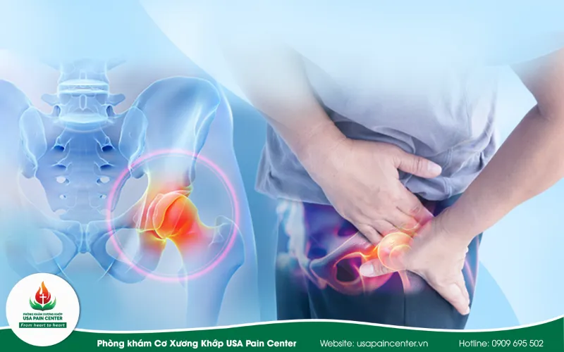 Bao khớp háng bị thắt chặt