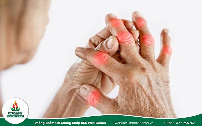 Triệu chứng thường gặp đau nhức từ vai xuống ngón tay