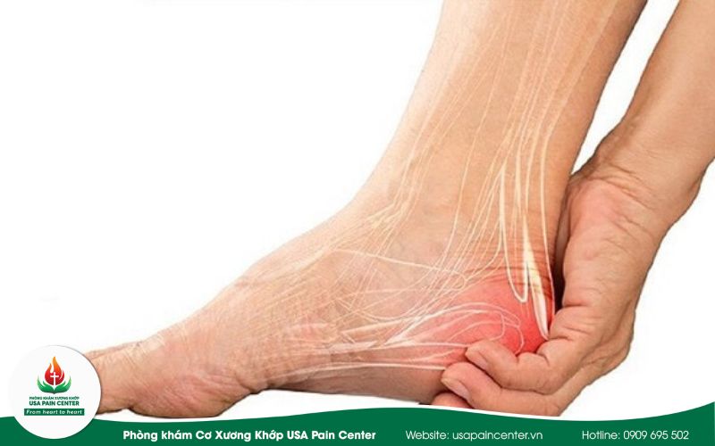 Giải Phóng Chuỗi Cơ Sau & Gót Chân Achilles: Phác Đồ Không Dùng Thuốc Tại USA Pain Center
