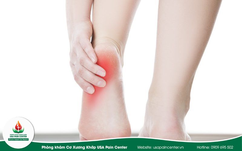 Các dấu hiệu cảnh báo chấn thương gân achilles