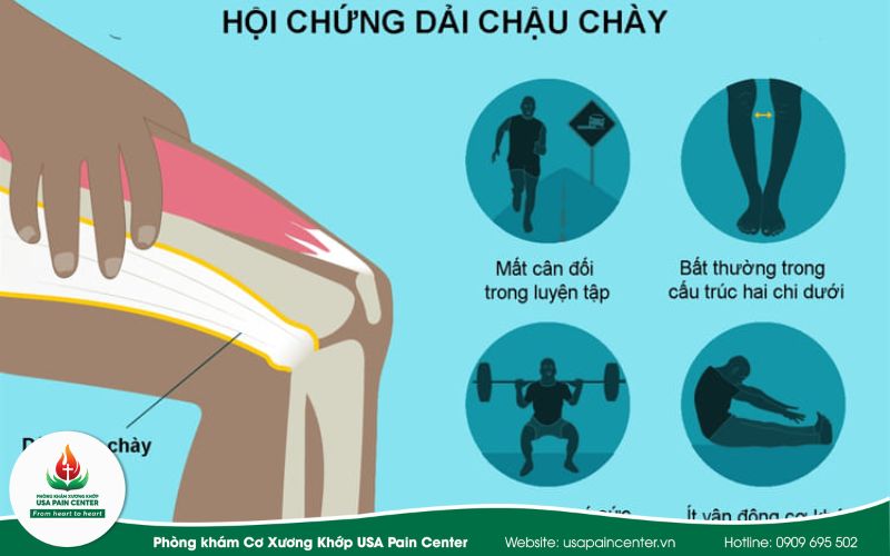Nới lỏng dải chậu chày & cơ mác: Giải pháp trị liệu tận gốc cơn đau mặt ngoài chân