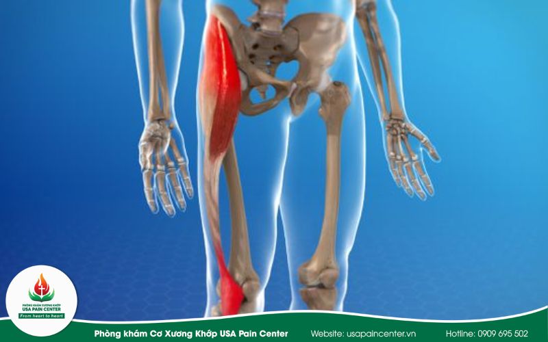 Bản chất dải chậu chày và hệ thống cơ mặt ngoài 