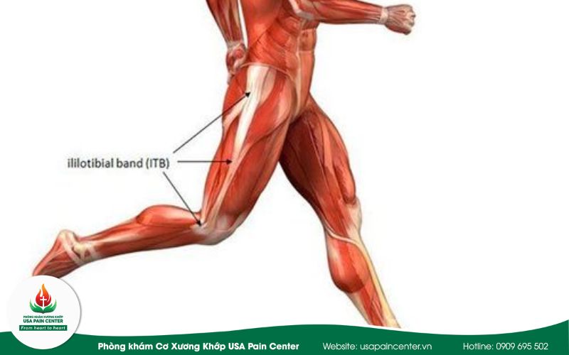 Dấu hiệu nhận biết hội chứng dải chậu chày