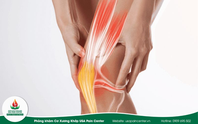 Liệu pháp nới lỏng dải chậu chày & cơ mác bằng tay – Sự khác biệt tại USA Pain Center