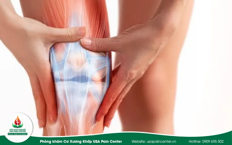 4 giai đoạn thoái hóa khớp gối