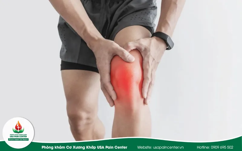 Định hướng phục hồi bảo tồn và duy trì sự khỏe mạnh cơ xương khớp cho người chơi Pickle ball