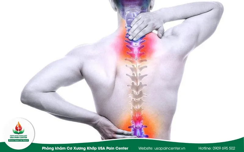 Ăn gì tốt cho người đau xương khớp