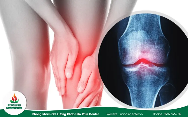 Nguyên nhân bị lỏng khớp gối và cách điều trị