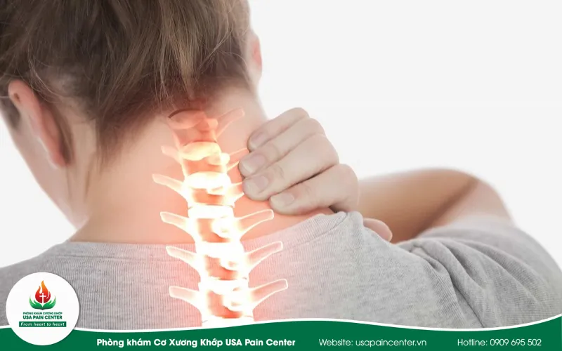 Cảnh báo y tế: Ngủ dậy bị đau cổ – Khi nào cần can thiệp y khoa khẩn cấp?
