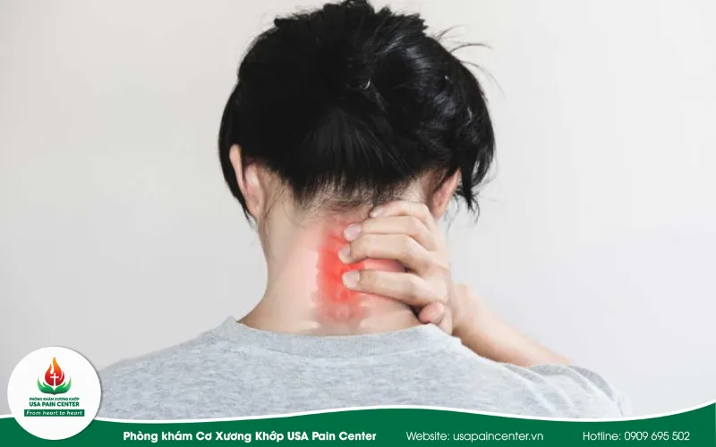 Giải phẫu chuyên sâu & Cơ chế sinh lý bệnh: Tại sao ngủ dậy bị đau cổ?