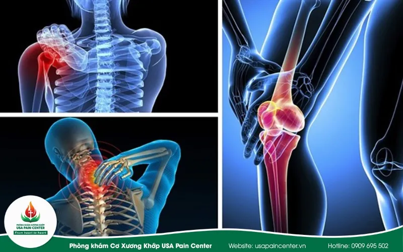 Nội cơ xương khớp là khám gì? Danh mục bệnh lý và lưu ý cần biết