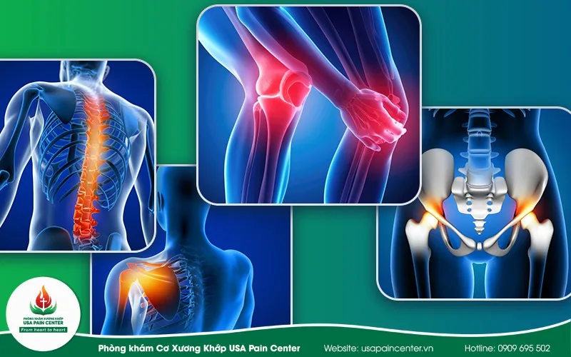 Khám nội cơ xương khớp là gì?