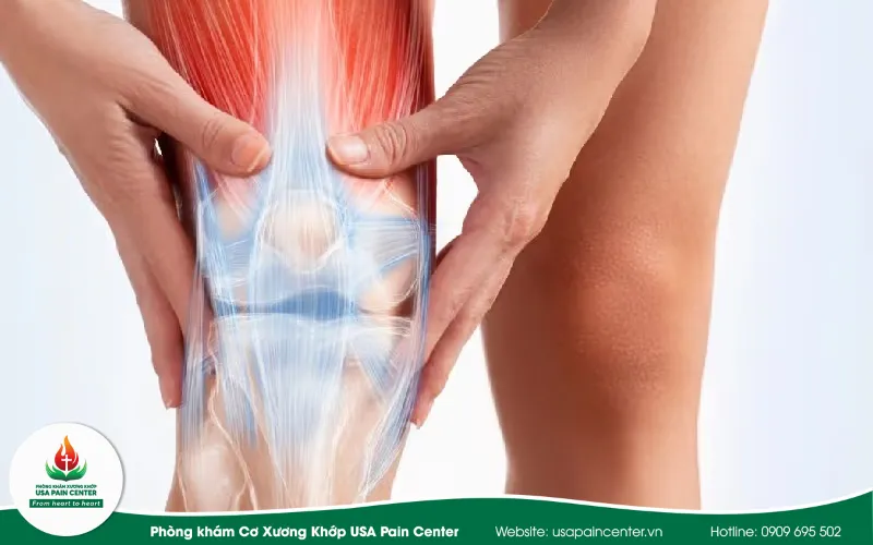 Bị thoái hóa khớp gối là gì dưới góc nhìn động lực học khớp?